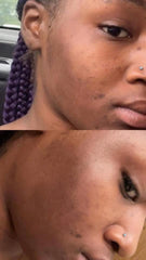 Turmeric Face Cleanse Pads